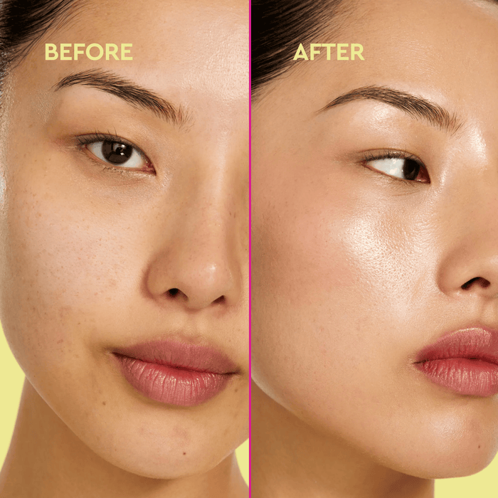 Before and after comparison of a woman's face with visible skin improvement.